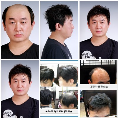 에이모가발 이미지