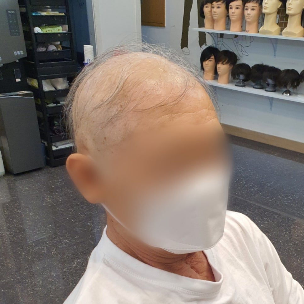김호증모가발by헤어리서치 이미지