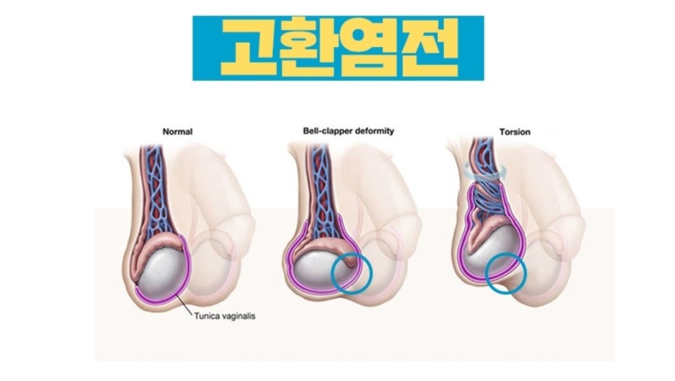 베스트비뇨기과 이미지