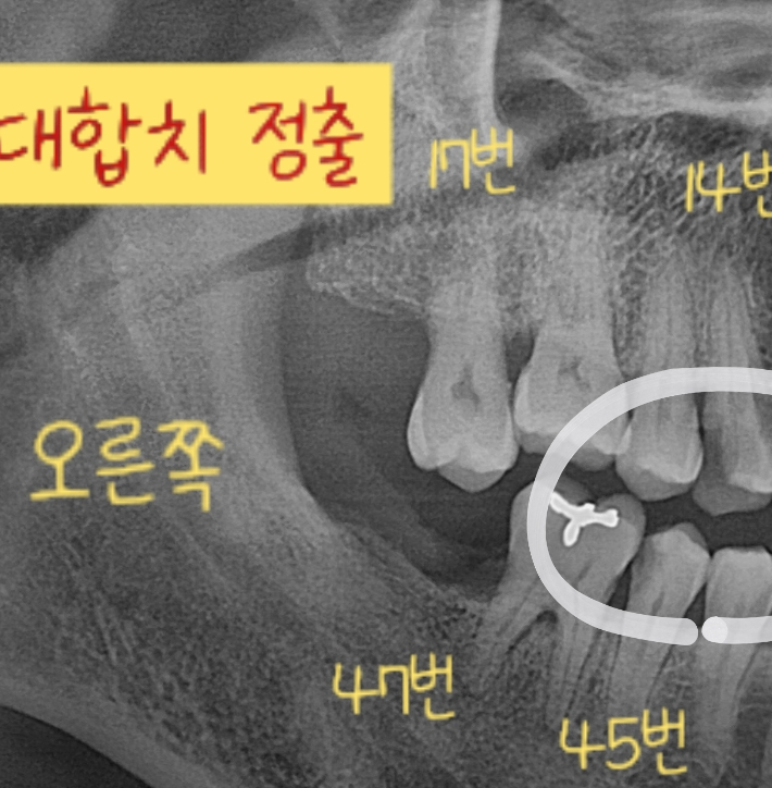 유천플란트치과 이미지