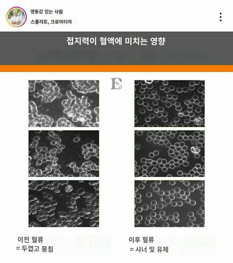 삼태기 이미지