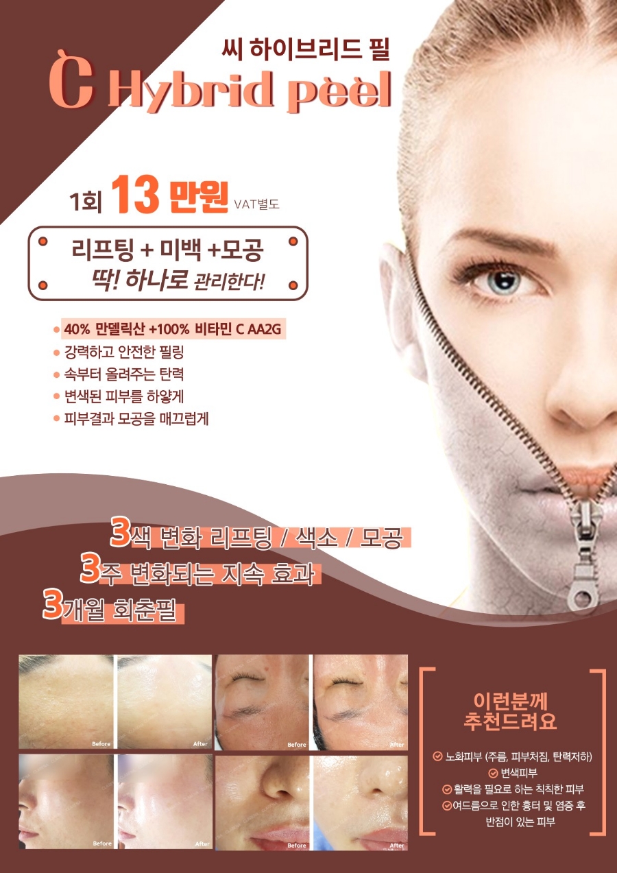 필로엘 이미지
