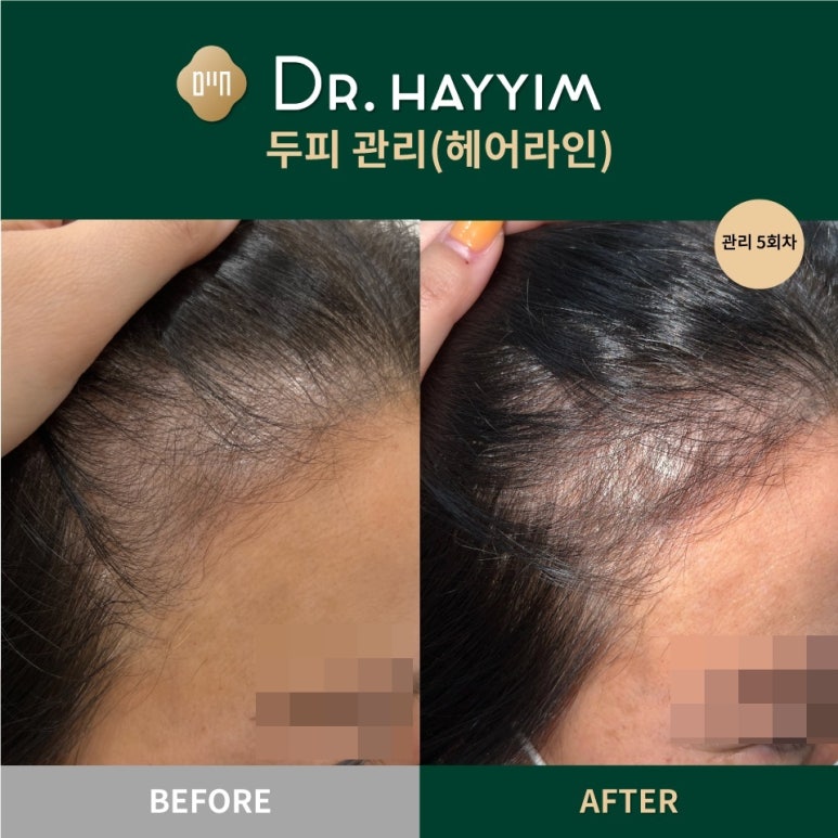 해라뷰티 이미지