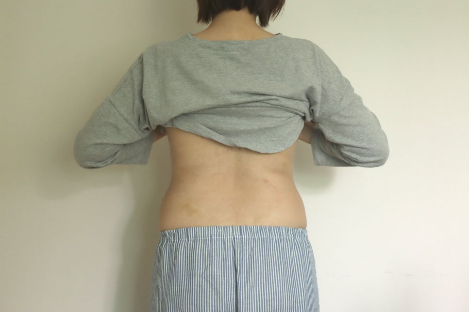 윤석란 바디케어 이미지