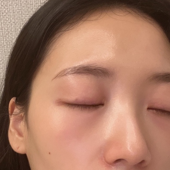라비드에스테틱 이미지