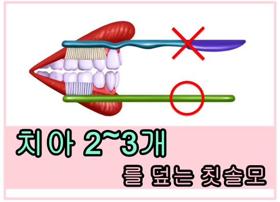우리가족치과 이미지