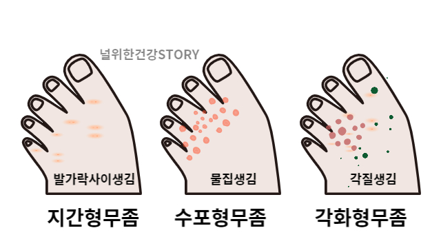 널 위한 건강 STORY* : 네이버 블로그