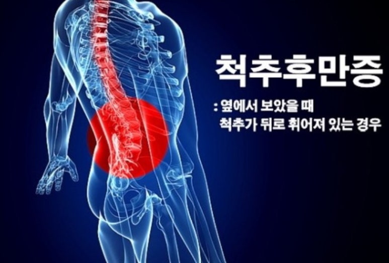 더우아 이미지