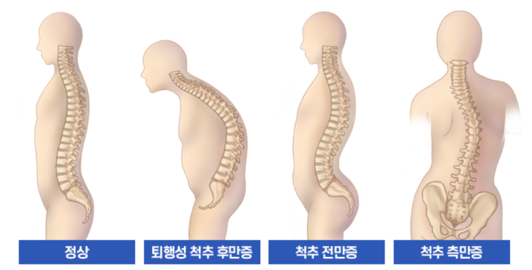 더우아 이미지