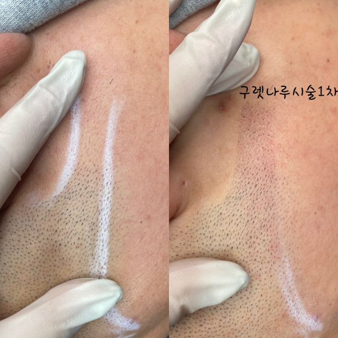 에이아이앤비 이미지