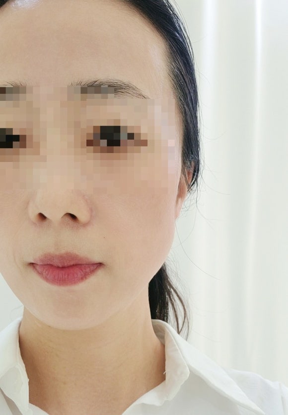더이쁜피부 이미지