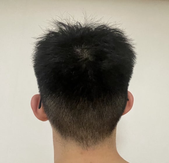 새치와까망머리 이미지