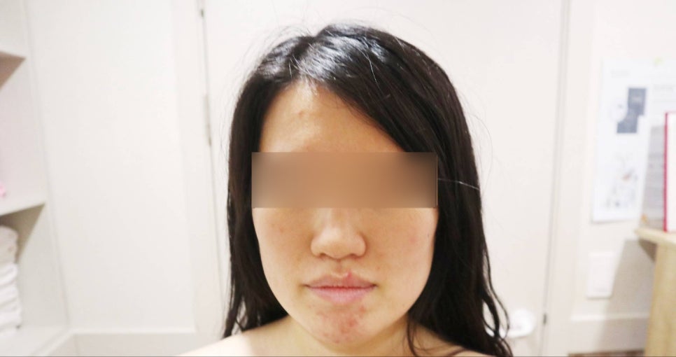 힐링수 이미지