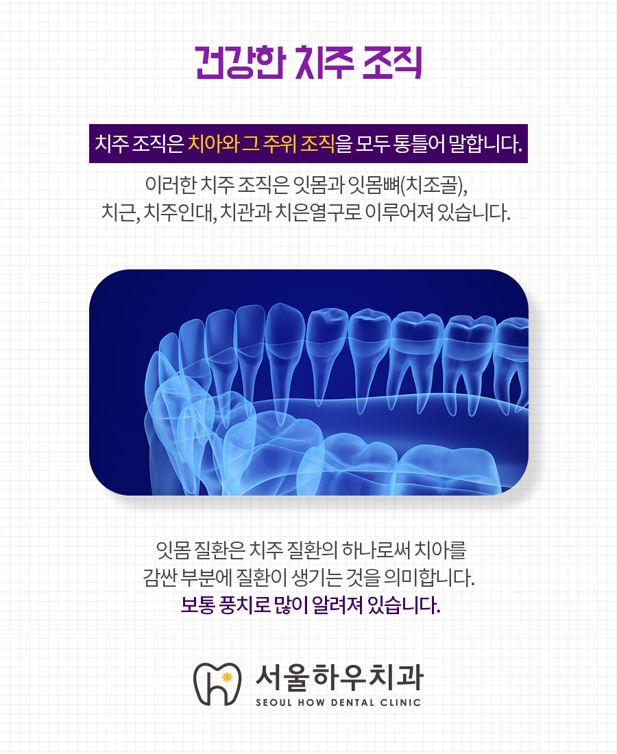 서울하우치과 이미지