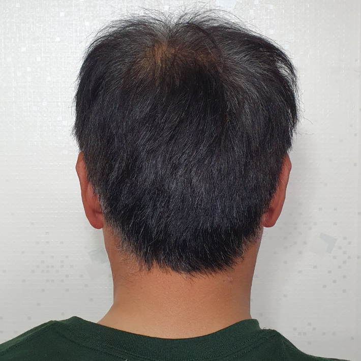새치와까망머리 이미지