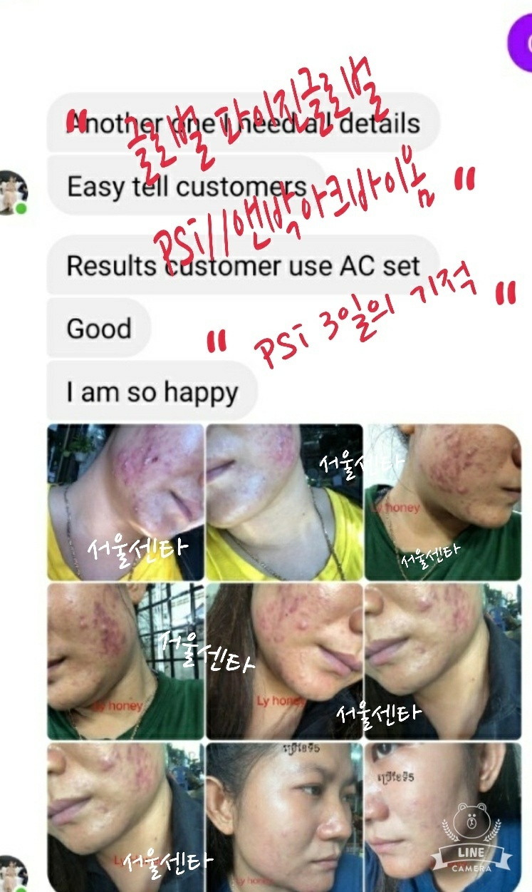 피부아지트(뉴페이스) 이미지