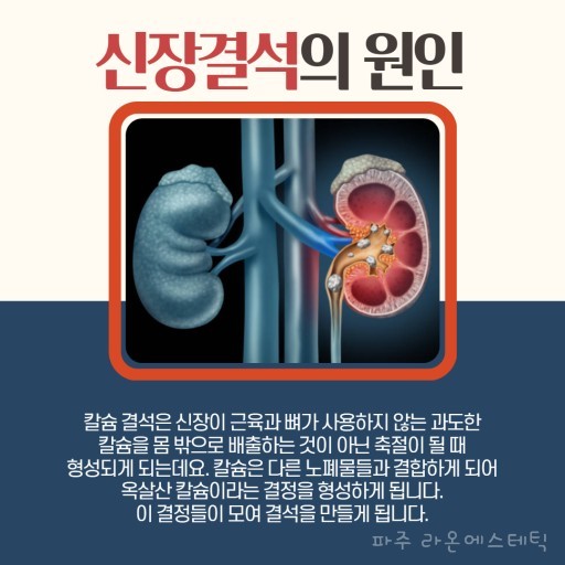 라온스파 이미지