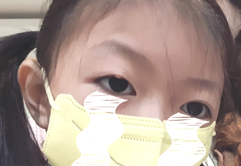 참빛안과 이미지
