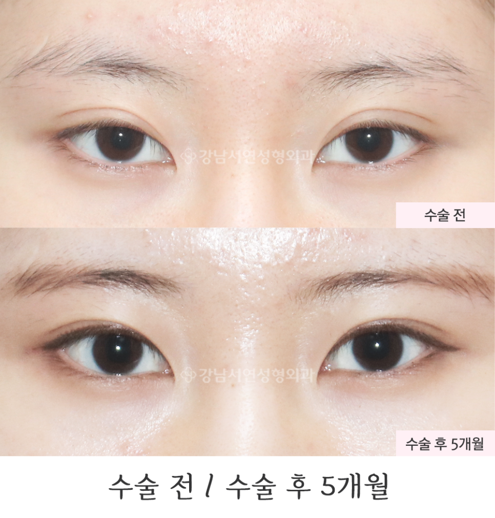 서연성형외과의원 이미지