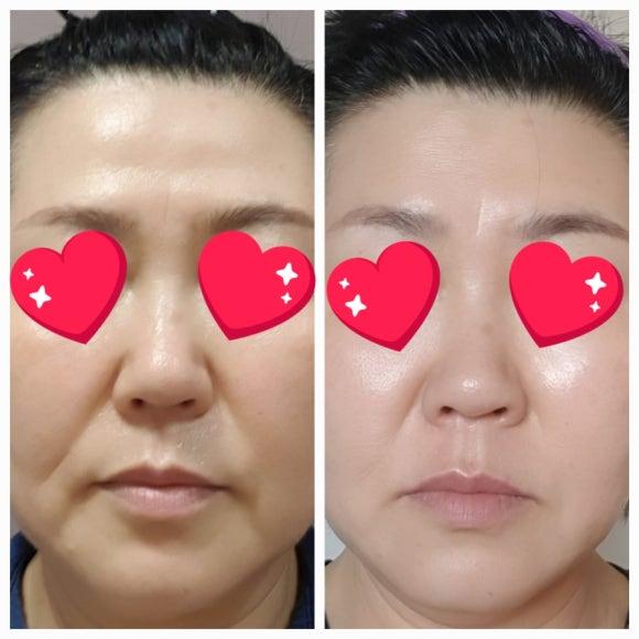 더블인셀덤 이미지