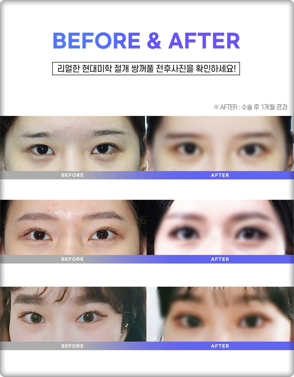 황호성형외과 이미지