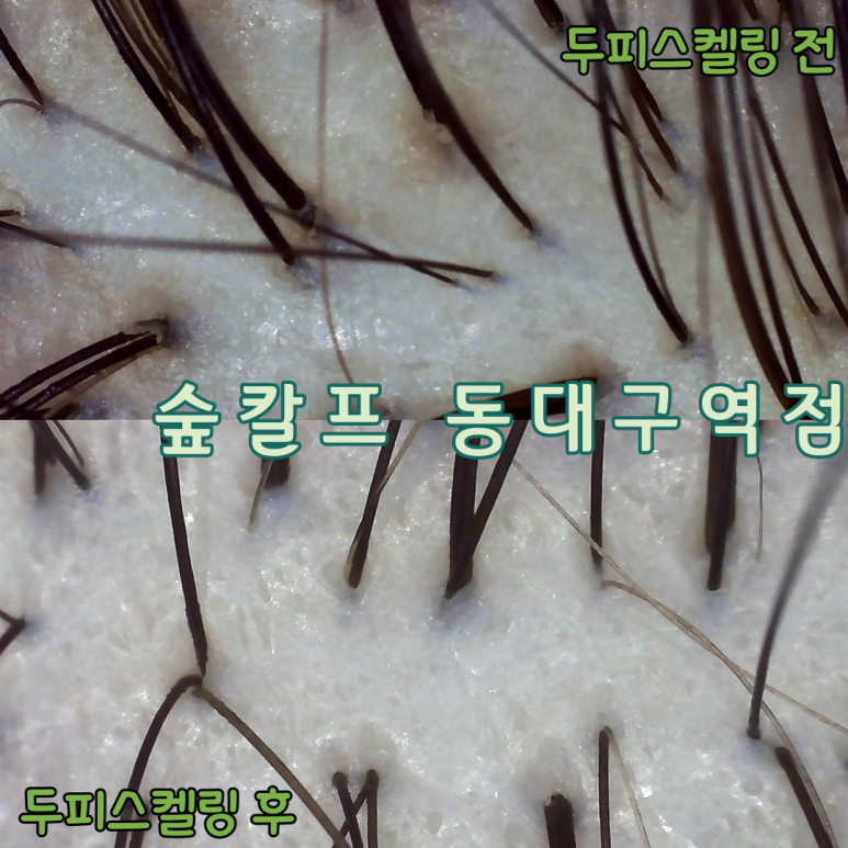 숲칼프 동대구역점 이미지