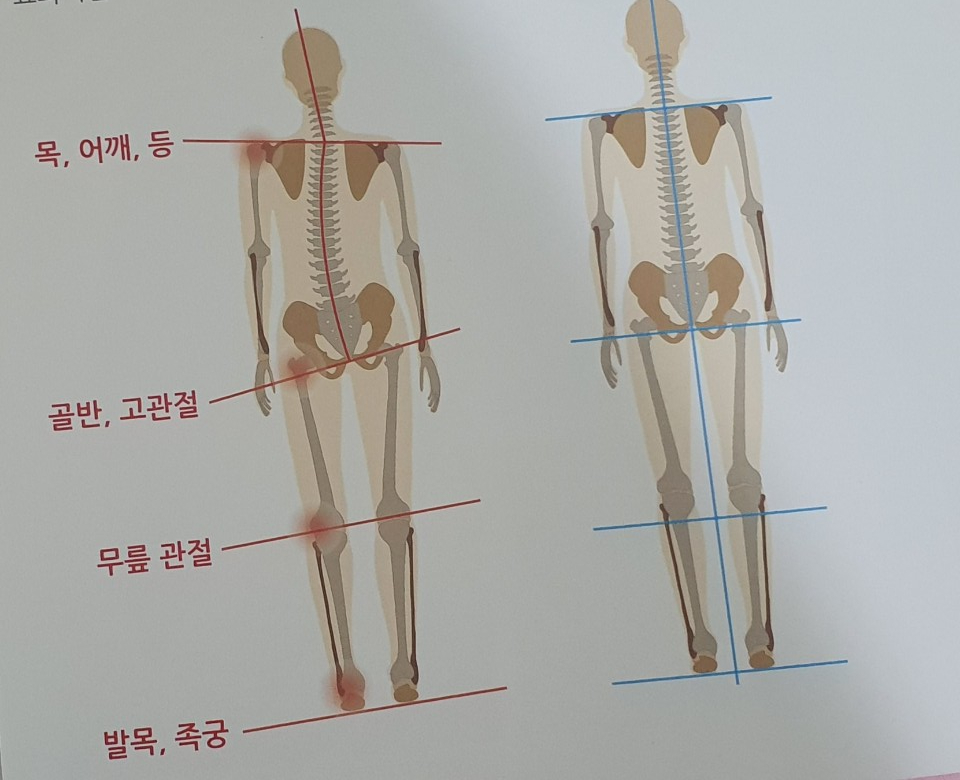 알즈너대한 이미지