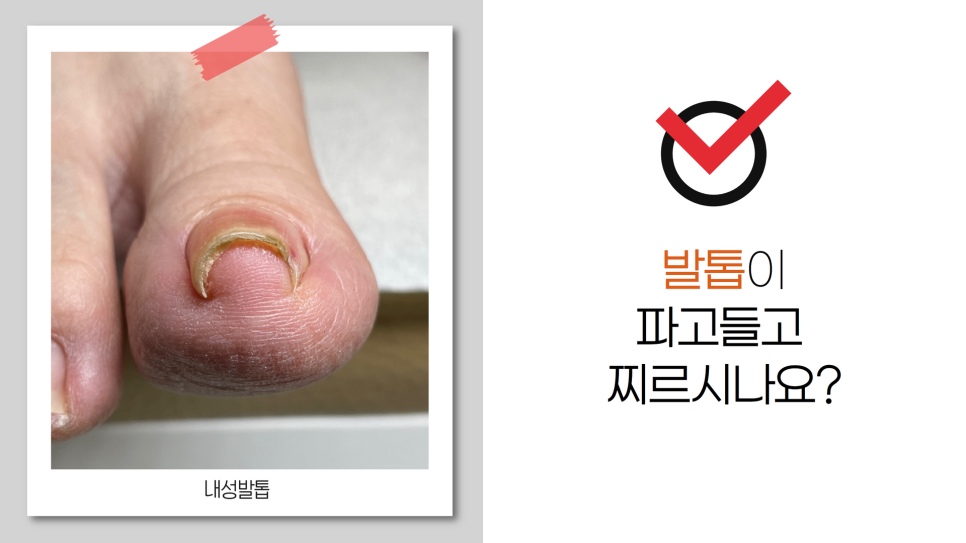엔피케어강남 이미지