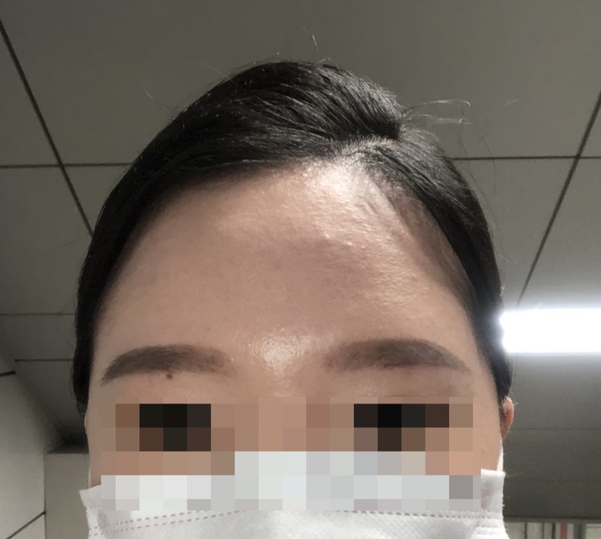 써니브로우 이미지