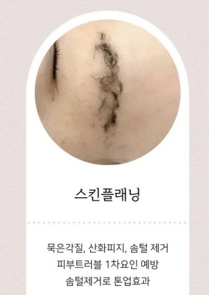 메이크라라 이미지