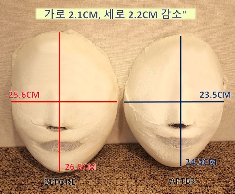 황금마사지 피부관리 이미지
