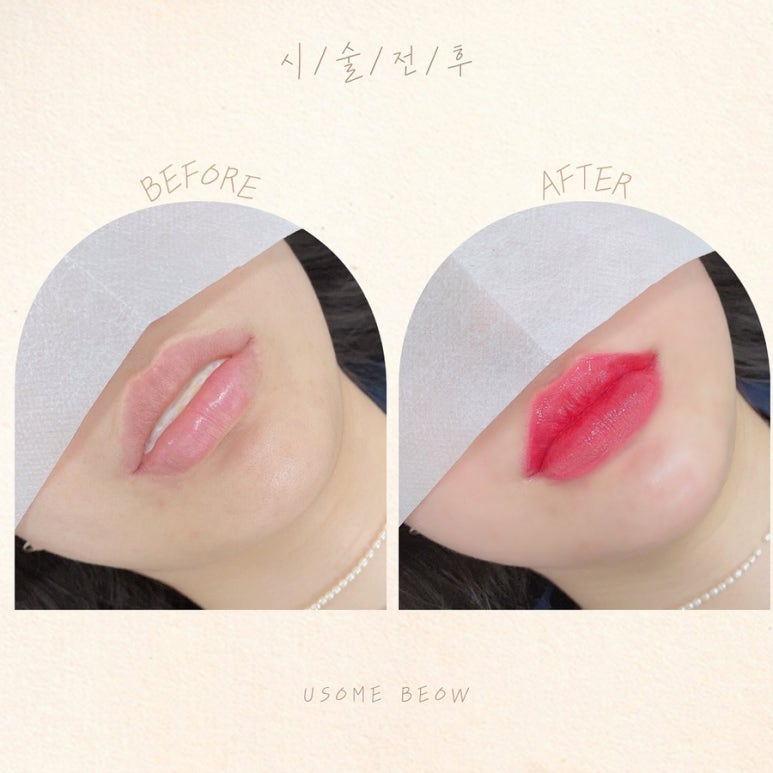 유썸 이미지