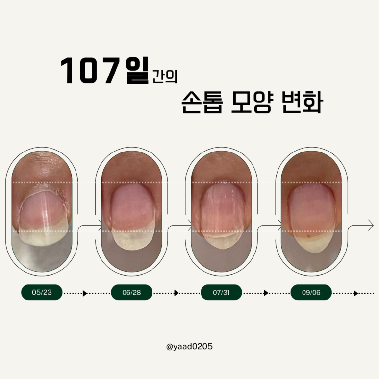 야아드네일앤왁싱 이미지