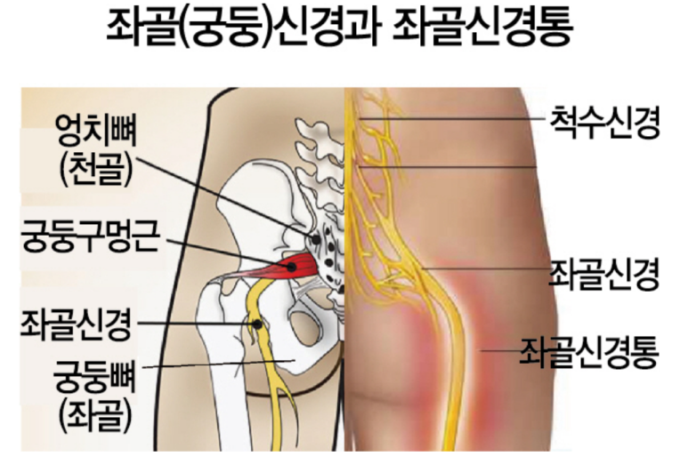 더우아 이미지