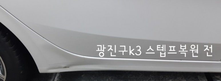 에이스덴트마스터 이미지