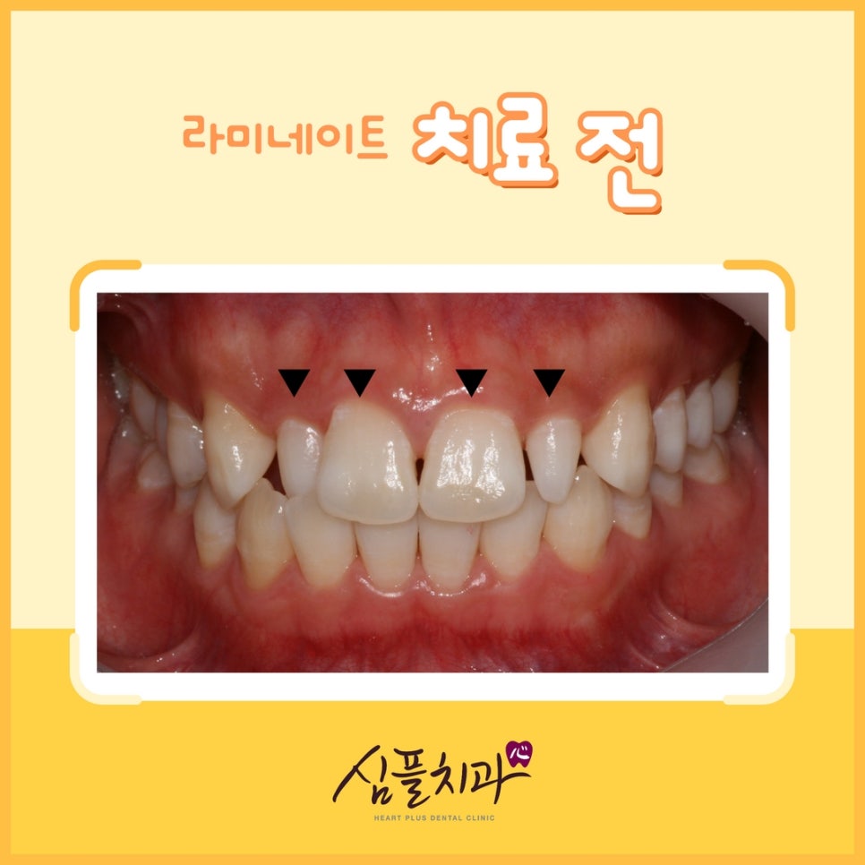 심플치과 이미지