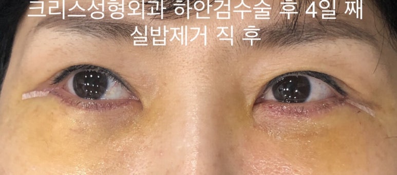 자연스럽게 이미지