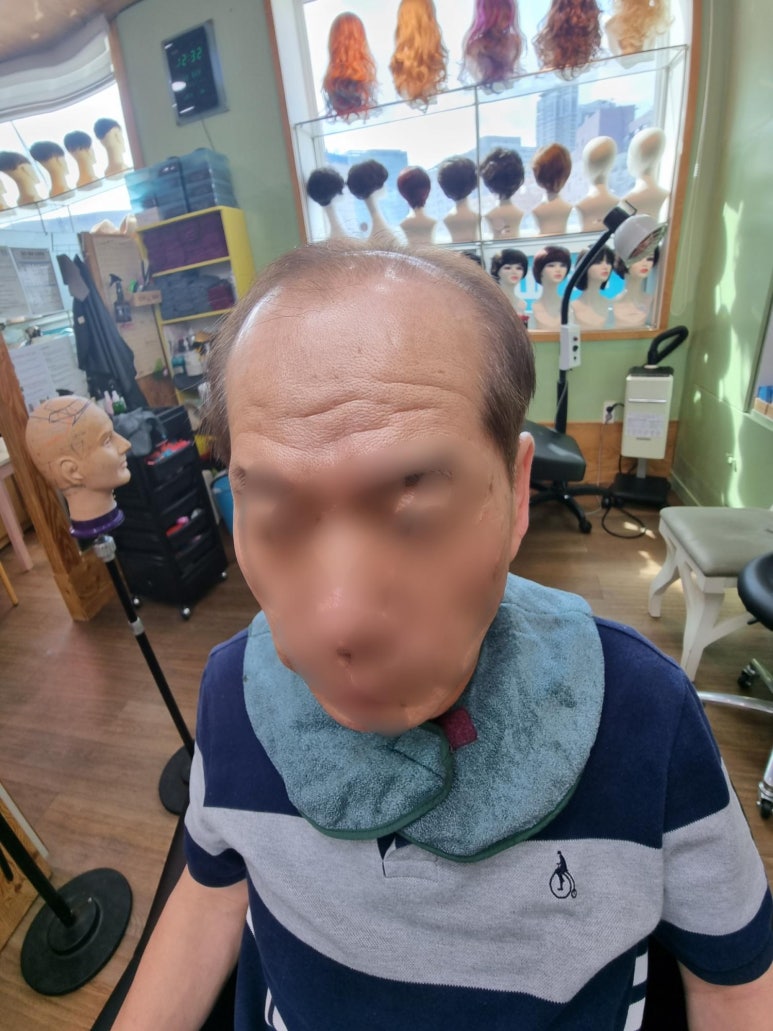 영등포가발 두해 이미지