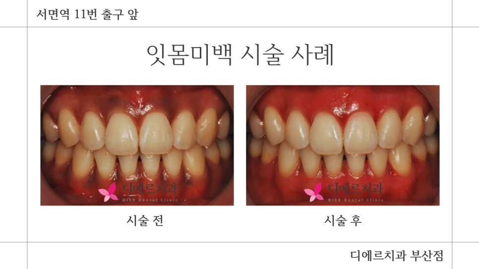 디에르치과의원 이미지