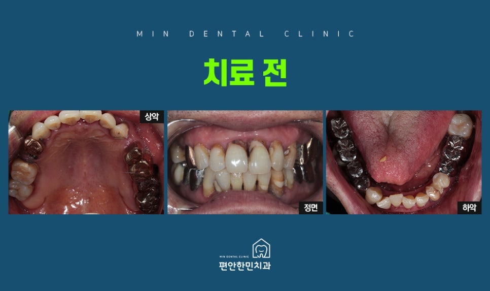 편안한민치과 이미지