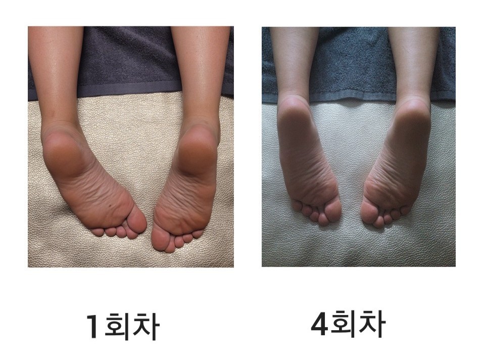 위더스산후케어 이미지
