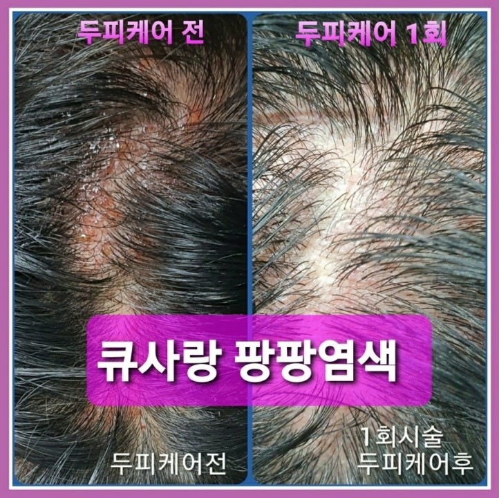큐사랑&뷰티 이미지