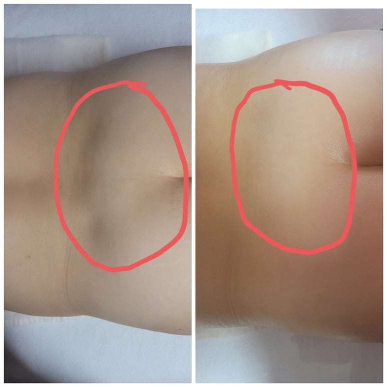 초이테라피 이미지