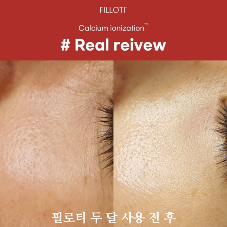 피부빛나다 이미지