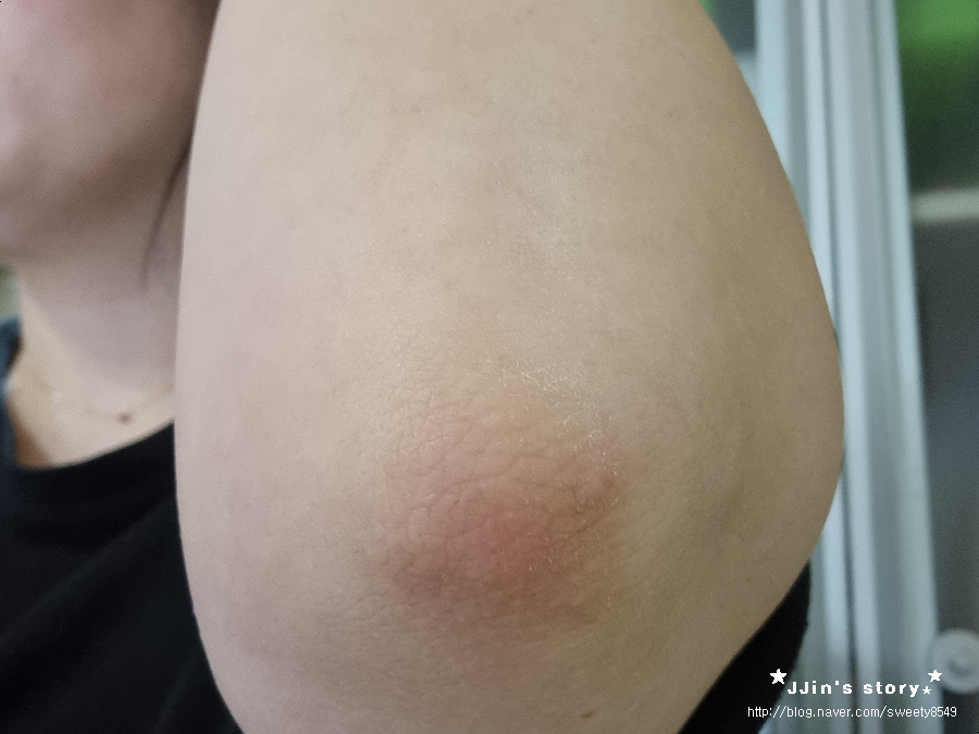 뷰티영 이미지