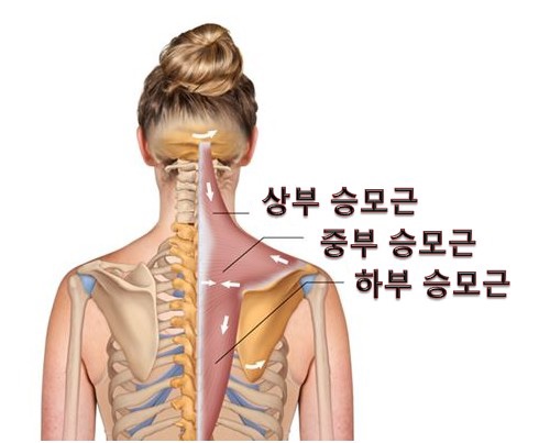 골드체형관리 이미지