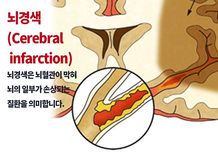대한가설 이미지