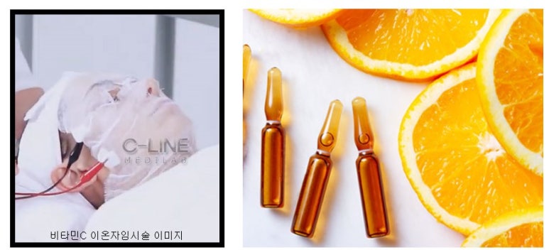 마스터토탈케어 이미지