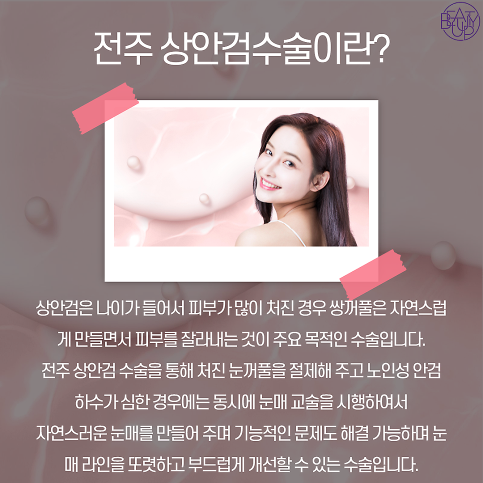 강남뷰티업성형외과 이미지
