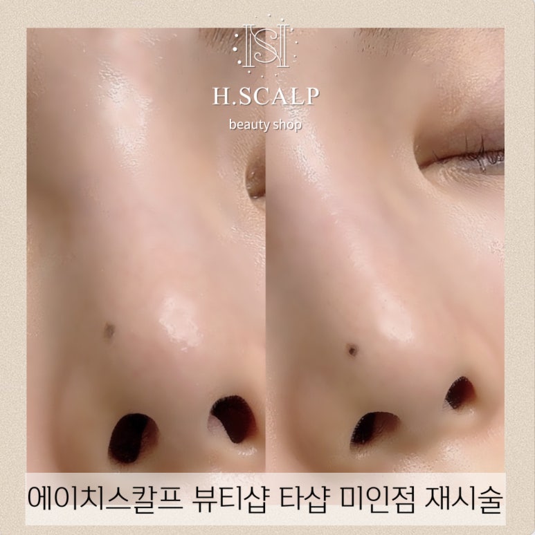 에이치뷰티 이미지